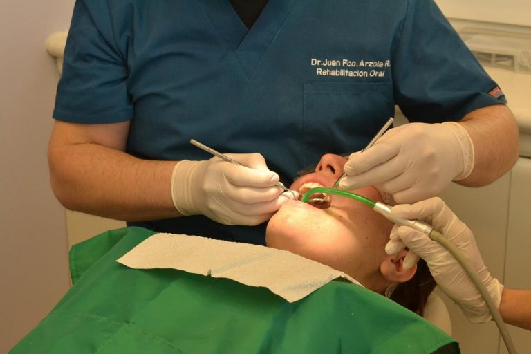 Zębowe implanty które powinny być w waszych szczękach